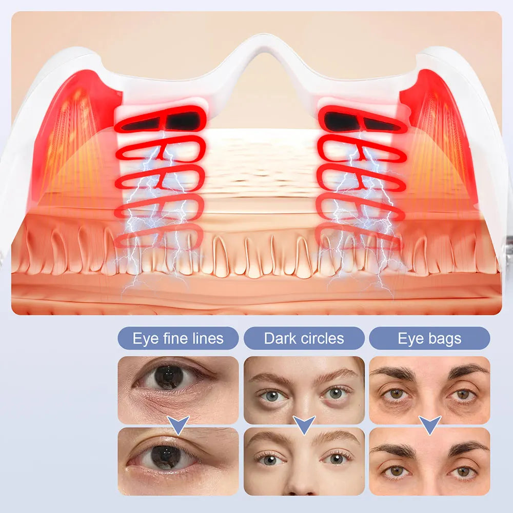 Eye Massage Device Eye Care Lifting Tightening Dark Circles Eye Bag Removal
